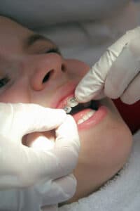  Orthodontist adjusting braces on a patient representing orthodontist marketing services