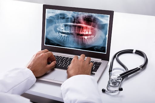 Dentist reviewing a digital dental X ray on laptop representing digital marketing for orthodontists and modern practice technology